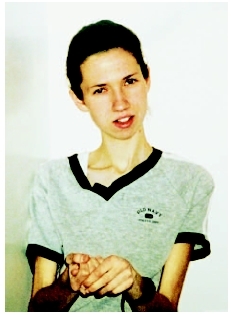 Extreme weight loss in an anorexic adolescent. ( Ed Quinn/Corbis.)