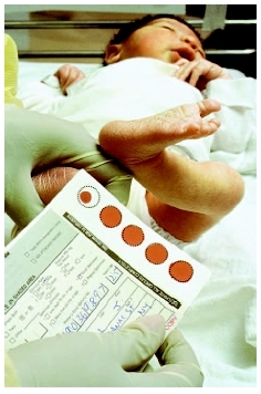Blood taken from the heel of a newborn to test the level of bilirubin. ( Ted Horowitz/Corbis.)