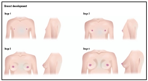 The four stages of breast development. In Stage 1 shows the flat breasts of childhood. By Stage 2, breast buds are formed as milk ducts and fat tissue develop. In Stage 3, the breast become round and full, and the areola darkens. Stage 4 shows 