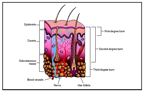 There are three classifications of burns: first-degree, second-degree, and third-degree burns. (Illustration by Electronic Illustrators Group.)