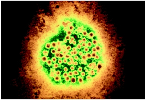 Hepatitis A virus magnified 225,000 times. ( 1990 Custom Medical Stock Photo, Inc.)