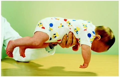 A six-week-old baby girl is held horizontally by the trunk in a test for hypotonia, sometimes called floppy infant syndrome. The girl is normal. (Saturn Stills/Science Photo Library/Photo Researchers, Inc.)