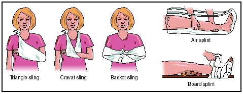 These illustrations feature several types of immobilization techniques, including slings and splints. (Illustration by Electronic Illustrators Group.)