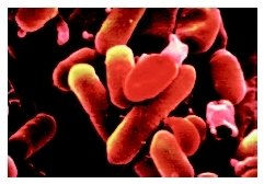 Scanning electron micrograph (SEM) scan of lysteria monocytogenes. ( CNRI/Phototake.)