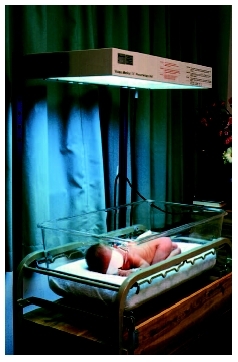 A newborn baby undergoes phototherapy with visible blue light to treat his jaundice. (Photograph by Ron Sutherland. Photo Researchers, Inc.)