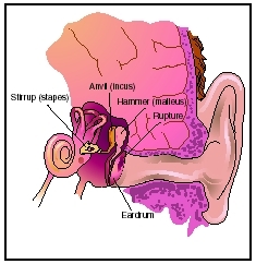 A perforated eardrum is a hole or rupture in the eardrum, the thin membrane that separates the outer ear canal from the middle ear. It may result in temporary hearing loss and occasional discharge. (Illustration by Electronic Illustrators Group