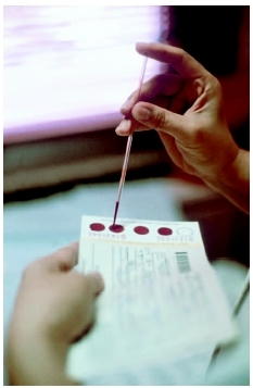 Blood taken from a newborns heel is tested for phenylketornuia (PKU). ( Custom Medical Stock Photo, Inc.)