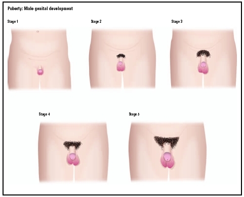 The five stages of male genital development. Stage 1 shows the undeveloped genitals of childhood. In Stage 2, pubic hair growth begins and the testicles begin to enlarge. By Stage 3, the penis grows longer and wider. The testicles continue to e