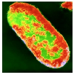 A transmission electron microscopy (TEM) scan of Shigella, a genus of aerobic bacteria that causes dysentery in humans and animals. (Custom Medical Stock Photo Inc.)