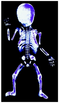 X ray showing the skeleton of a newborn. Gaps between bones indicate cartilage, which will develop into bone tissue as the child ages. ( Howard Sochurek/Corbis.)